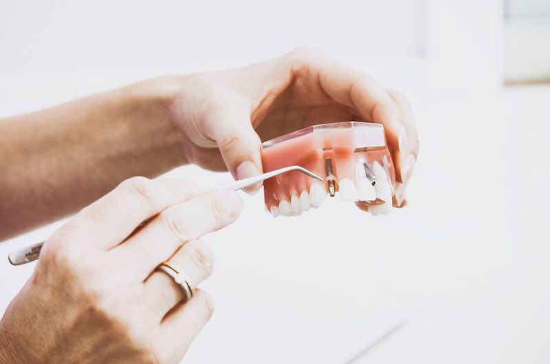 Choosing a Dental Insurance Plan